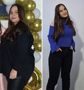 Gastric Sleeve Before After 4